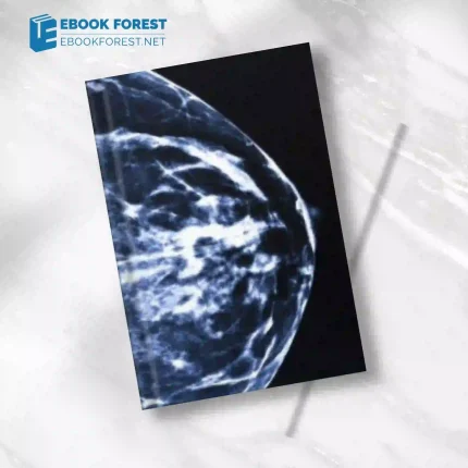 UCSF Breast Imaging and Digital Mammography 2014 (Videos)
