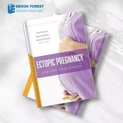 Ectopic Pregnancy: Endless Challenges.2022 Original PDF