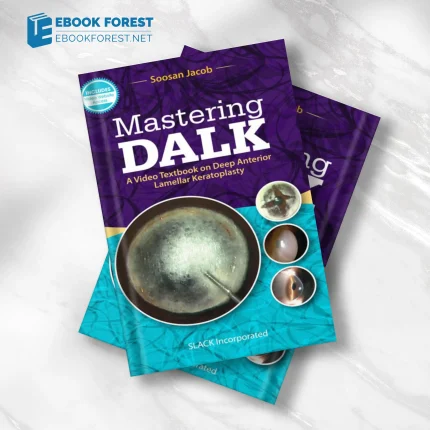 Mastering DALK: A Video Textbook on Deep Anterior Lamellar Keratoplasty .2019 Original PDF