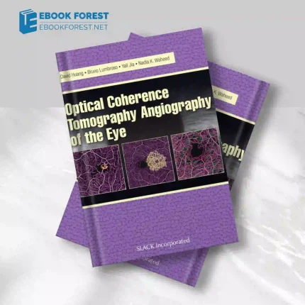 Optical Coherence Tomography Angiography of the Eye (Original PDF from Publisher)