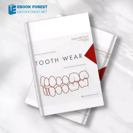 Tooth Wear: Interceptive Treatment Approach With Minimally Invasive Protocols .2023 Original PDF