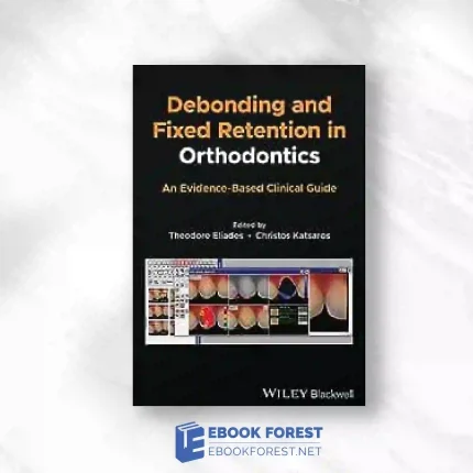 Debonding And Fixed Retention In Orthodontics: An Evidence-Based Clinical Guide.2023 Original PDF