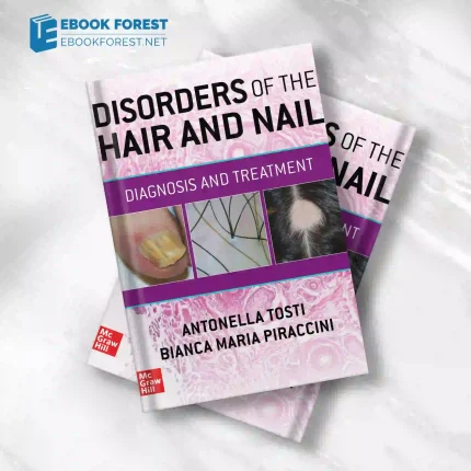 Disorders of the Hair and Nail: Diagnosis and Treatment.2023 Original PDF
