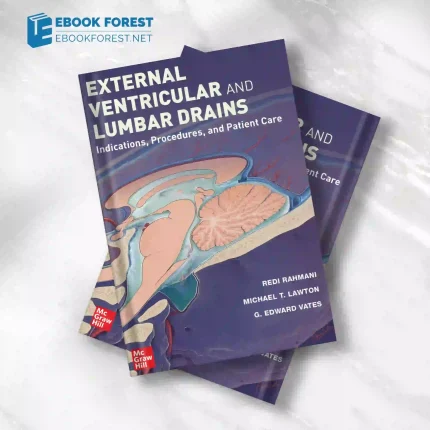 External Ventricular and Lumbar Drains: Indications, Procedures, and Patient Care.2023 Original PDF