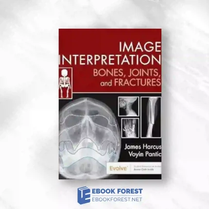 Image Interpretation: Bones, Joints, And Fractures.2023 Original PDF