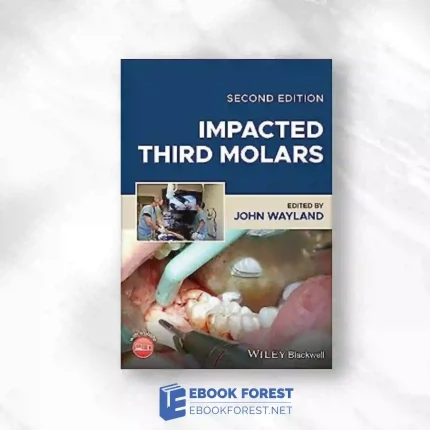 Impacted Third Molars, 2nd Edition.2023 Original PDF