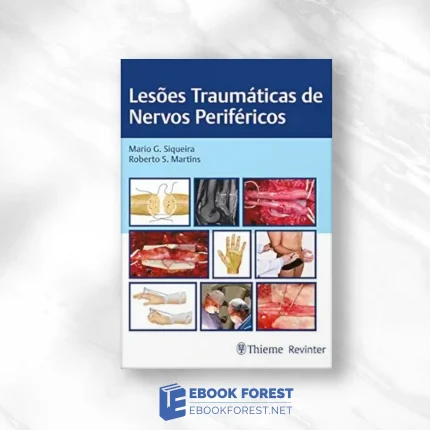 Lesões Traumáticas De Nervos Periféricos (Portuguese Edition).2022 EPUB and converted pdf