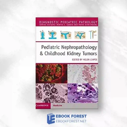 Pediatric Nephropathology & Childhood Kidney Tumors (Diagnostic Pediatric Pathology).2023 Original PDF