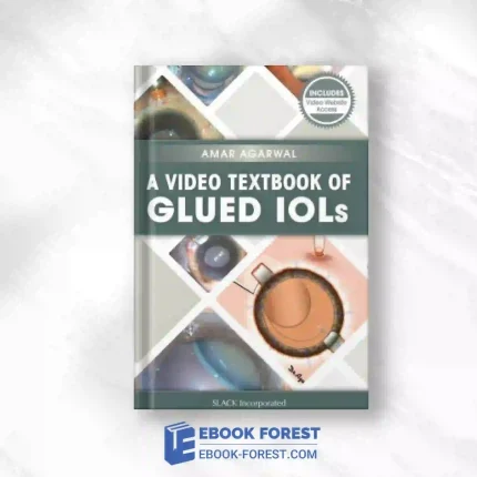 A Video Textbook Of Glued IOLs.2016