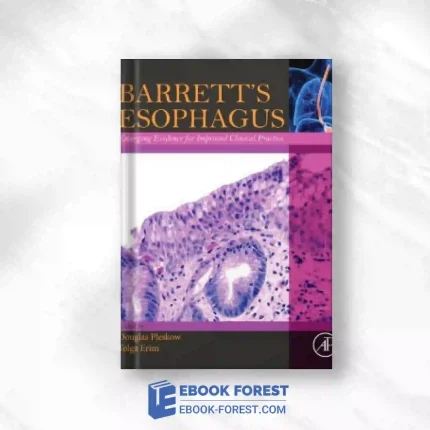 Barrett’s Esophagus: Emerging Evidence For Improved Clinical Practice.2016