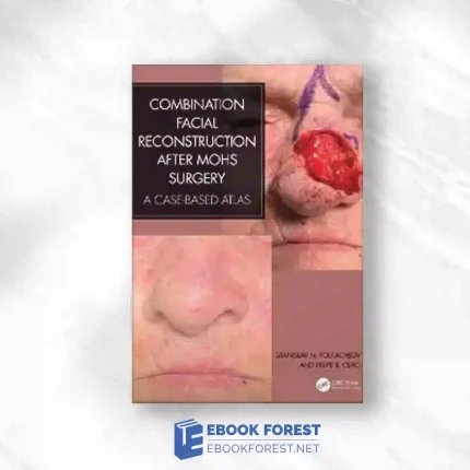 Combination Facial Reconstruction After Mohs Surgery: A Case Based Atlas.2023 Original PDF