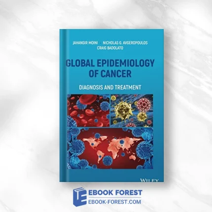 Global Epidemiology Of Cancer: Diagnosis And Treatment ,2022 Original PDF