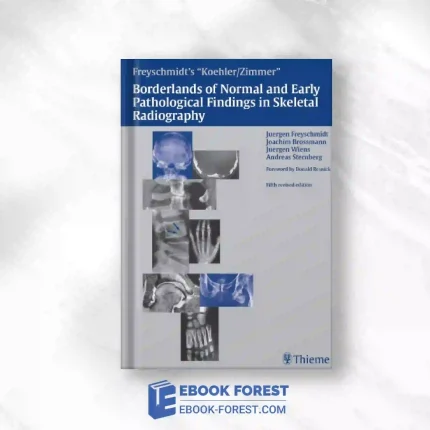 Koehler/Zimmer’s Borderlands Of Normal And Early Pathological Findings In Skeletal Radiography, 5th Edition.2011 Original PDF