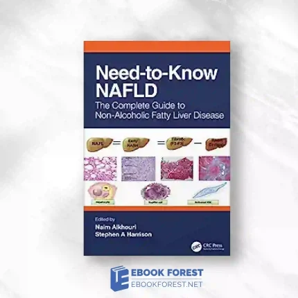Need-To-Know NAFLD: The Complete Guide To Nonalcoholic Fatty Liver Disease.2023 Original PDF