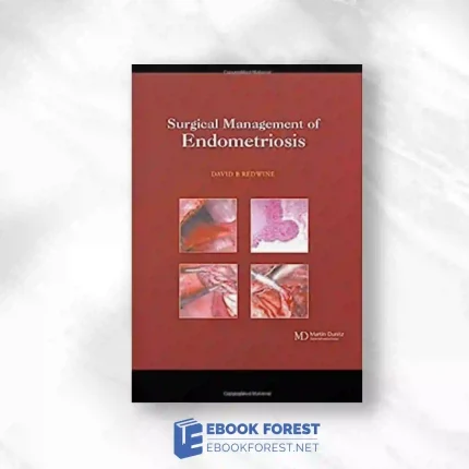 Surgical Management Of Endometriosis.2004 Original PDF
