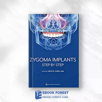 Zygoma Implants: Step By Step.2023 Original PDF