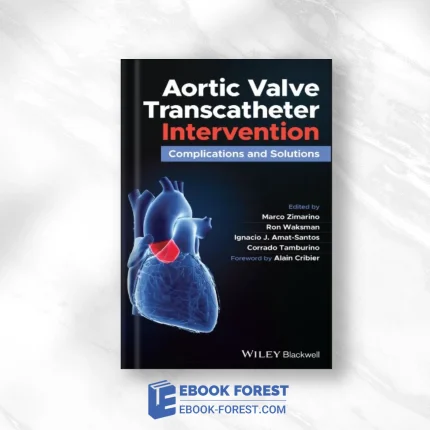 Aortic Valve Transcatheter Intervention: Complications And Solutions (EPUB)