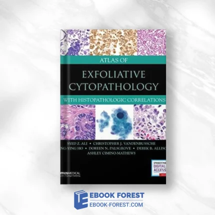 Atlas Of Exfoliative Cytopathology: With Histopathologic Correlations (EPUB)