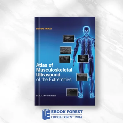 Atlas Of Musculoskeletal Ultrasound Of The Extremities (EPUB)