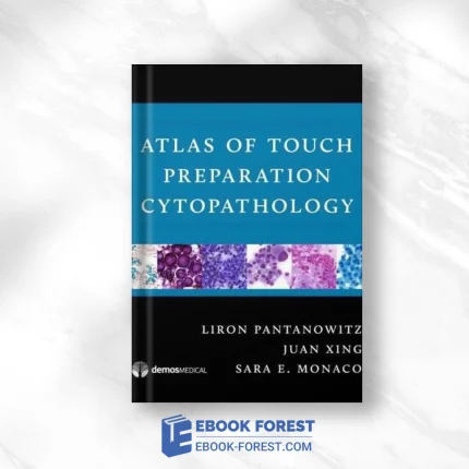 Atlas Of Touch Preparation Cytopathology (EPUB)