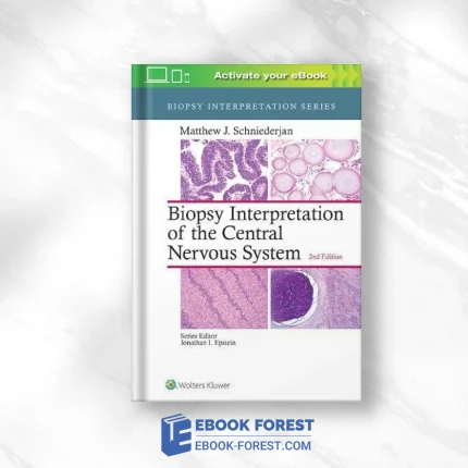 Biopsy Interpretation Of The Central Nervous System, 2nd Edition .2017 EPUB