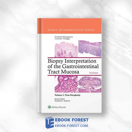 Biopsy Interpretation Of The Gastrointestinal Tract Mucosa: Volume 1: Non-Neoplastic, 3rd Edition .2017 EPUB