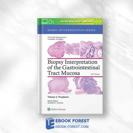 Biopsy Interpretation Of The Gastrointestinal Tract Mucosa: Volume 2: Neoplastic (Biopsy Interpretation Series), 3rd Edition .2017 EPUB