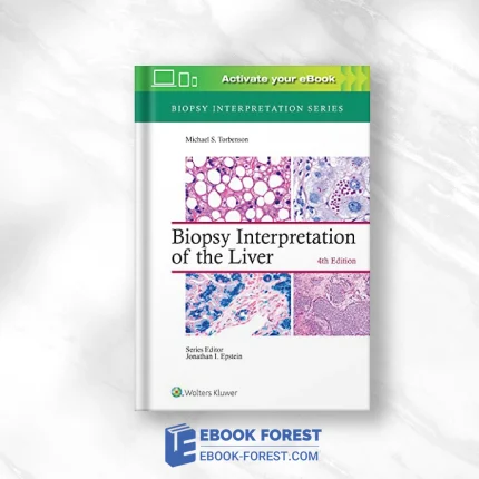 Biopsy Interpretation Of The Liver (Biopsy Interpretation Series), 4th Edition .2021 EPUB3 + Converted PDF