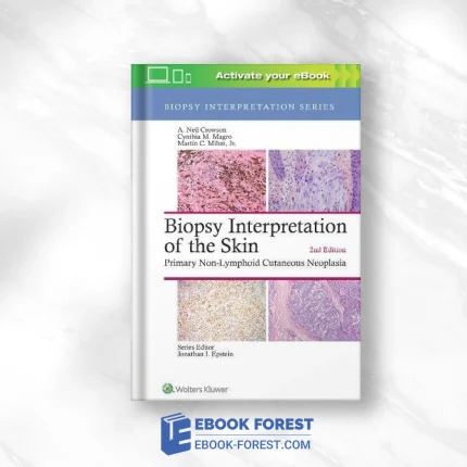 Biopsy Interpretation Of The Skin: Primary Non-Lymphoid Cutaneous Neoplasia, 2nd Edition (Biopsy Interpretation Series) .2018 EPUB
