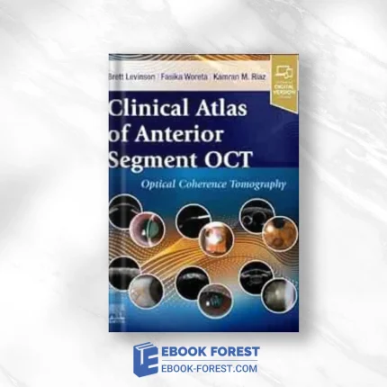 Clinical Atlas Of Anterior Segment OCT: Optical Coherence Tomography (True PDF)