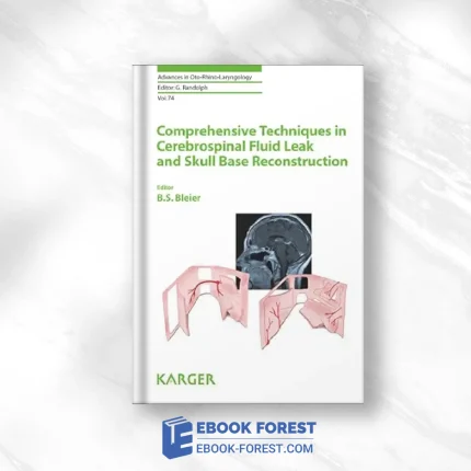 Comprehensive Techniques In CSF Leak Repair And Skull Base Reconstruction (Advances In Oto-Rhino-Laryngology Book 74) .2012 EPUB