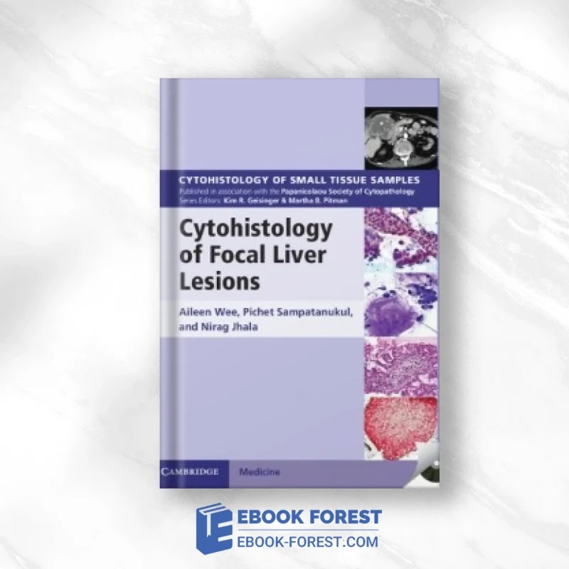 Cytohistology Of Focal Liver Lesions .2014 Original PDF From Publisher