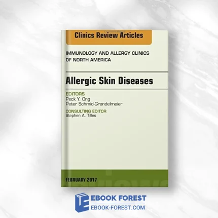 Allergic Skin Diseases, An Issue Of Immunology And Allergy Clinics Of North America, 1e (The Clinics: Internal Medicine) .2017 PDF
