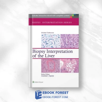 Biopsy Interpretation Of The Liver .2014 ORIGINAL PDF From Publisher