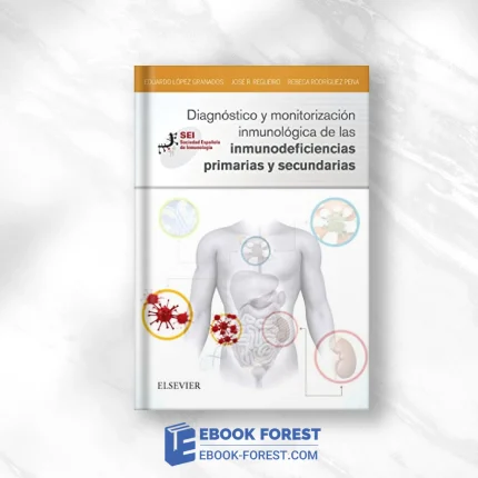 Diagnóstico Y Monitorización Inmunológica De Las Inmunodeficiencias Primarias Y Secundaria (Spanish Edition) .2017 EPUB